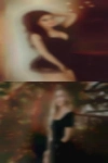 Psoriasis swinger warm her